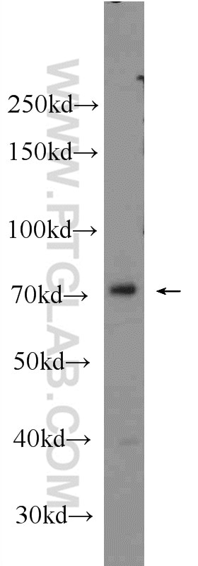 Western Blot (WB) analysis of K-562 cells using PRPF39 Polyclonal antibody (24480-1-AP)