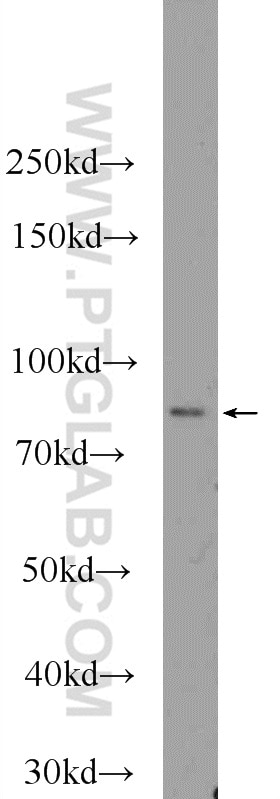 Western Blot (WB) analysis of Raji cells using PRPF39 Polyclonal antibody (24480-1-AP)