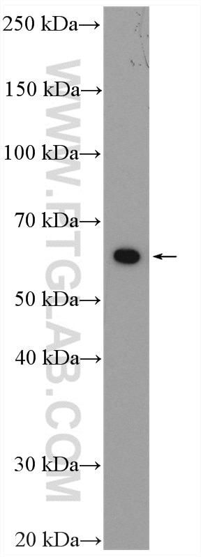 Western Blot (WB) analysis of HEK-293 cells using PRPF4 Polyclonal antibody (10728-1-AP)