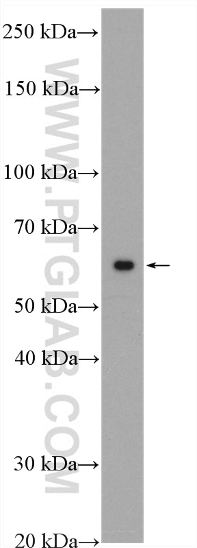 Western Blot (WB) analysis of HepG2 cells using PRPF4 Polyclonal antibody (10728-1-AP)