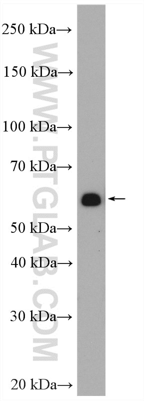 Western Blot (WB) analysis of Raji cells using PRPF4 Polyclonal antibody (10728-1-AP)