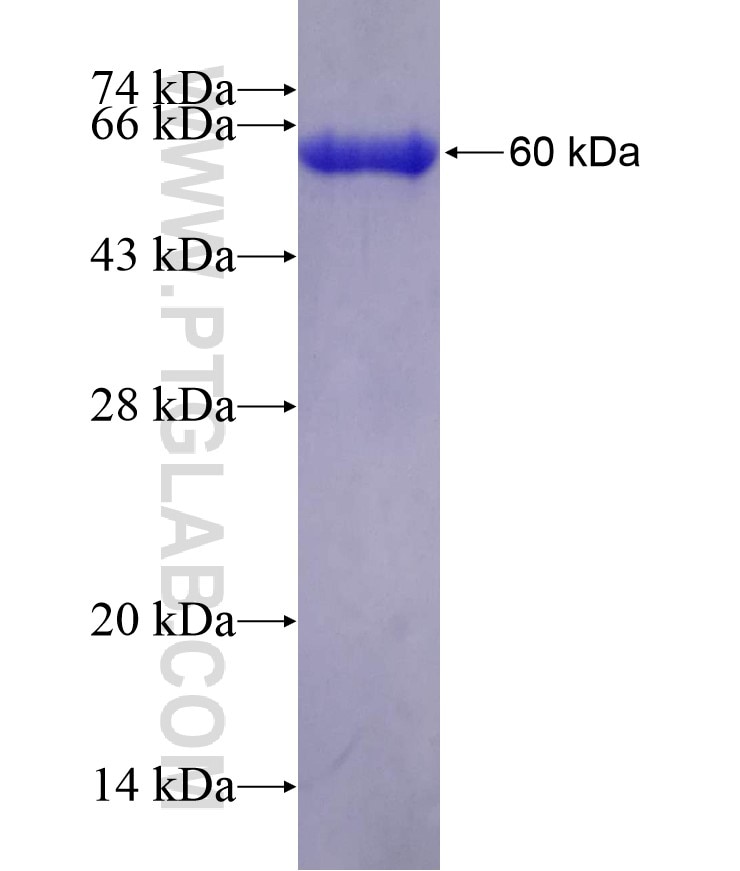PRPF4 fusion protein Ag1193 SDS-PAGE
