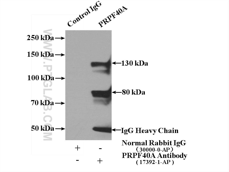 Immunoprecipitation (IP) experiment of HEK-293 cells using PRPF40A Polyclonal antibody (17392-1-AP)