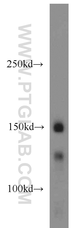 Western Blot (WB) analysis of mouse brain tissue using PRPF40A Polyclonal antibody (17392-1-AP)