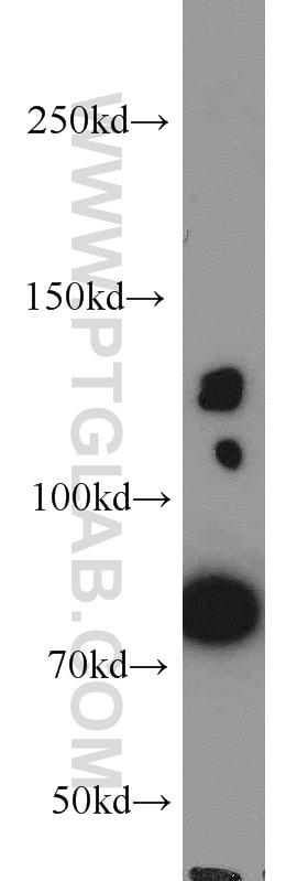 Western Blot (WB) analysis of HeLa cells using PRPF40A Polyclonal antibody (17392-1-AP)