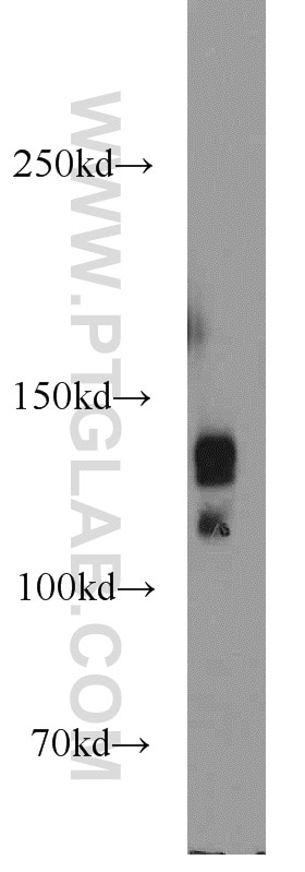 Western Blot (WB) analysis of HeLa cells using PRPF40A Polyclonal antibody (17392-1-AP)