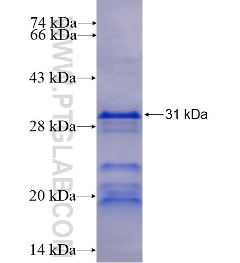 PRPF40A fusion protein Ag11159 SDS-PAGE