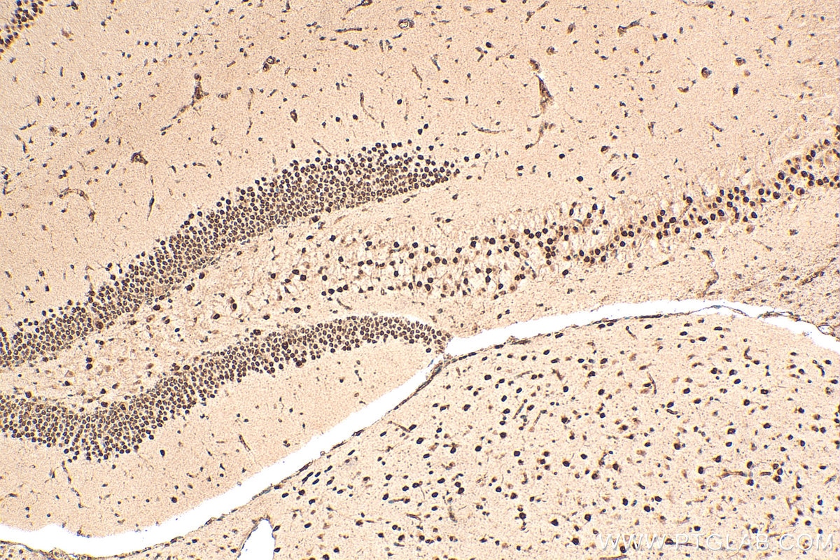 Immunohistochemical analysis of paraffin-embedded mouse brain tissue slide using 16929-1-AP (PRPF40B antibody) at dilution of 1:200 (under 10x lens). Heat mediated antigen retrieval with Tris-EDTA buffer (pH 9.0). Immunohistochemistry (IHC) staining of mouse brain tissue using PRPF40B Polyclonal antibody (16929-1-AP)