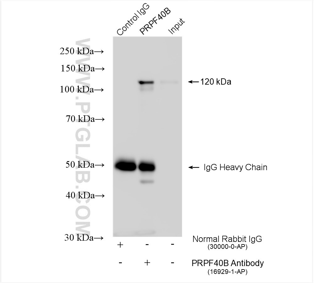 Immunoprecipitation (IP) experiment of Y79 cells using PRPF40B Polyclonal antibody (16929-1-AP)