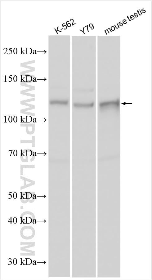 Western Blot (WB) analysis of various lysates using PRPF40B Polyclonal antibody (16929-1-AP)