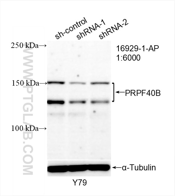 Western Blot (WB) analysis of Y79 cells using PRPF40B Polyclonal antibody (16929-1-AP)