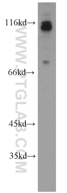 Western Blot (WB) analysis of Y79 cells using PRPF40B Polyclonal antibody (16929-1-AP)