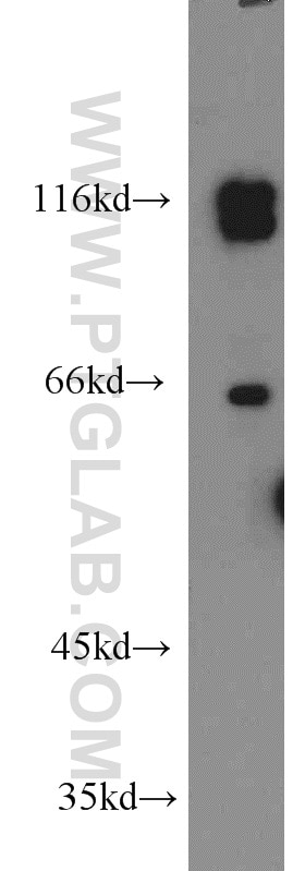 Western Blot (WB) analysis of Y79 cells using PRPF40B Polyclonal antibody (16929-1-AP)