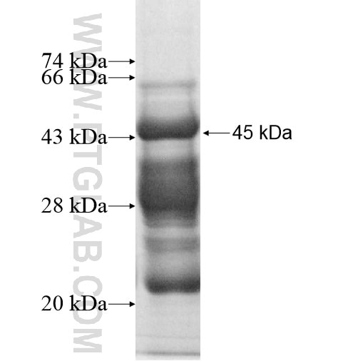PRPF40B fusion protein Ag10361 SDS-PAGE