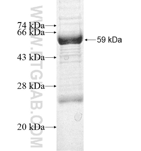 PRPF4B fusion protein Ag10587 SDS-PAGE