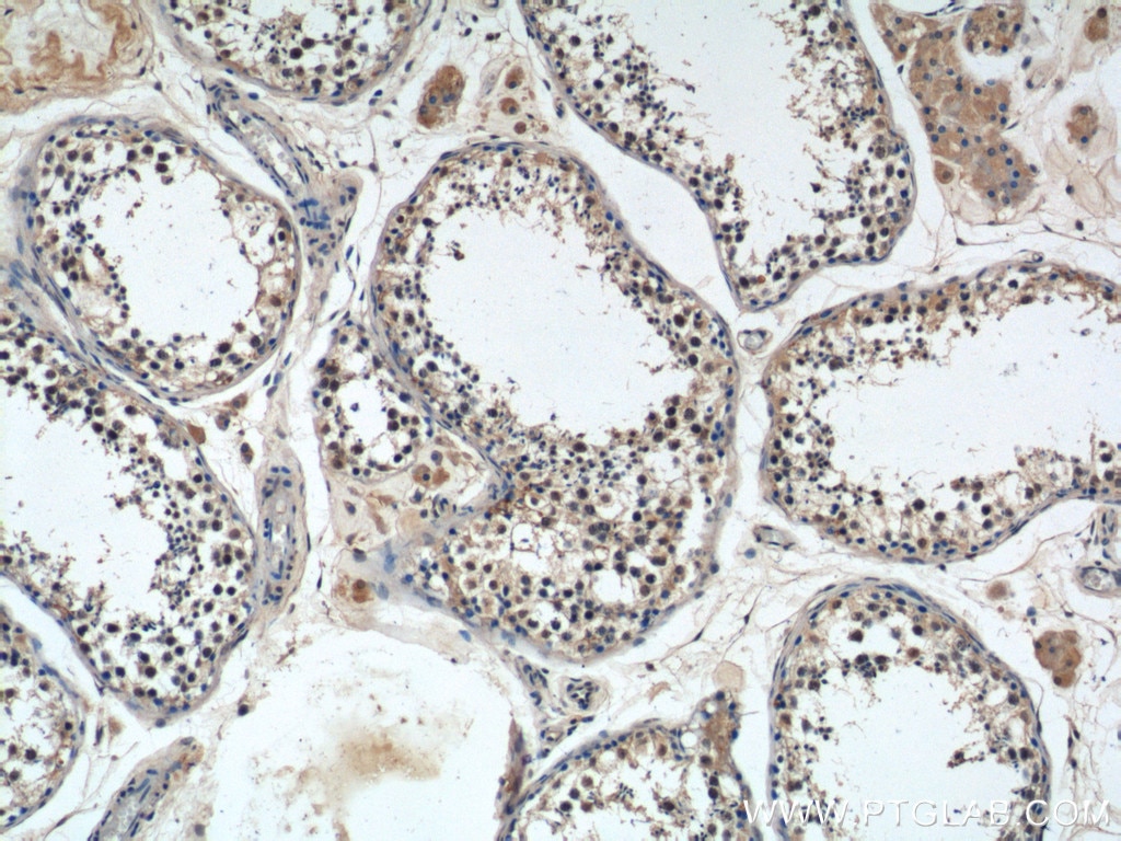 Immunohistochemistry (IHC) staining of human testis tissue using PRPF6 Polyclonal antibody (23929-1-AP)