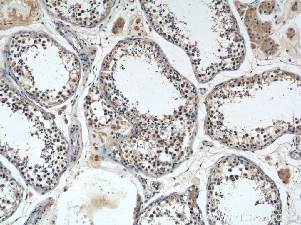 IHC staining of human testis using 23929-1-AP