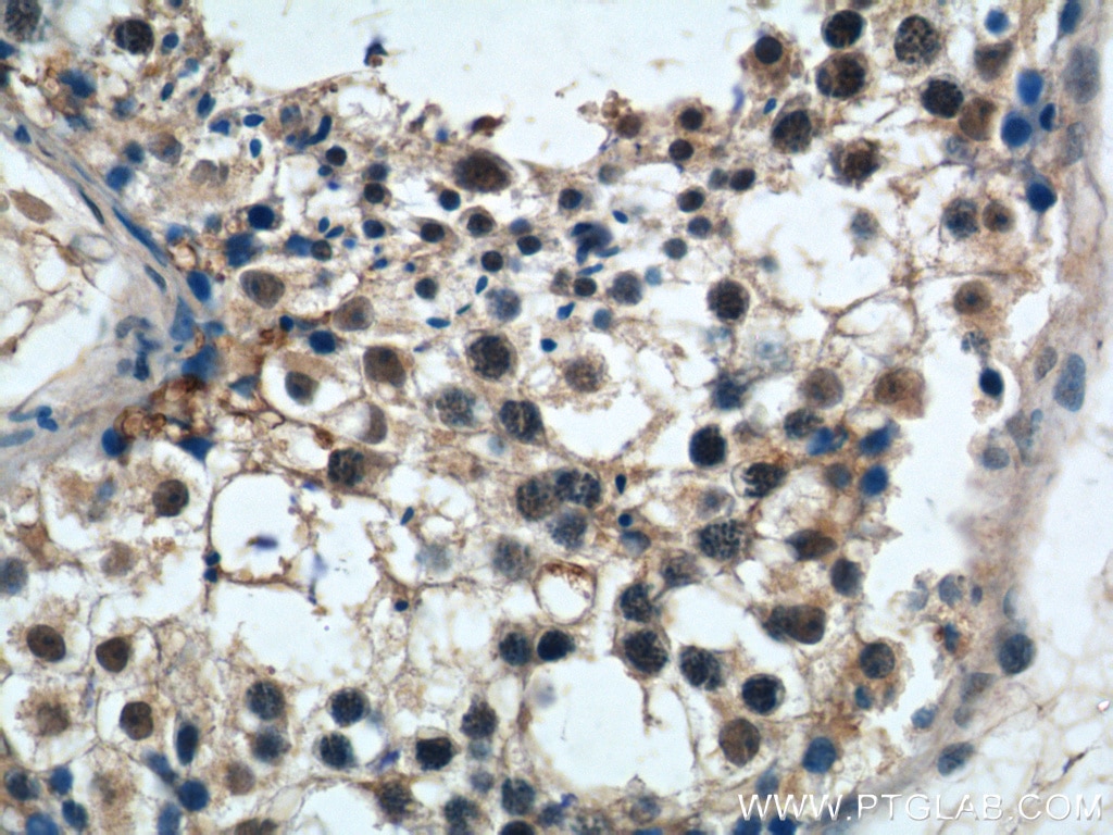 Immunohistochemistry (IHC) staining of human testis tissue using PRPF6 Polyclonal antibody (23929-1-AP)