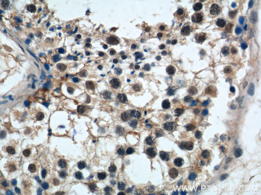 IHC staining of human testis using 23929-1-AP