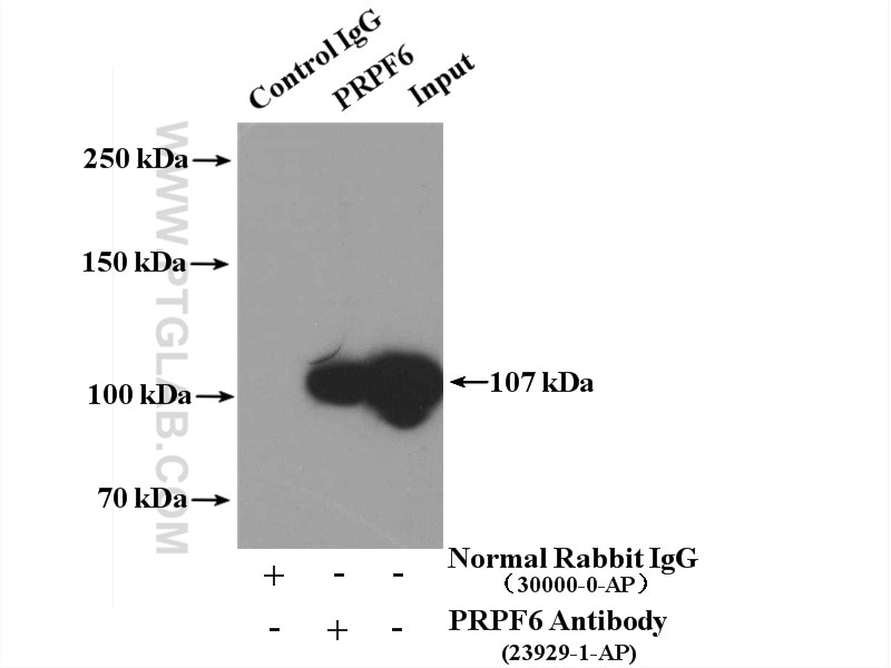 Immunoprecipitation (IP) experiment of HeLa cells using PRPF6 Polyclonal antibody (23929-1-AP)