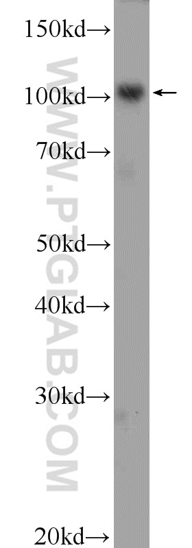 Western Blot (WB) analysis of HeLa cells using PRPF6 Polyclonal antibody (23929-1-AP)