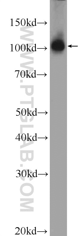 Western Blot (WB) analysis of HEK-293 cells using PRPF6 Polyclonal antibody (23929-1-AP)