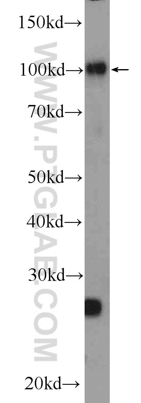 Western Blot (WB) analysis of NIH/3T3 cells using PRPF6 Polyclonal antibody (23929-1-AP)