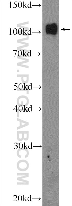 Western Blot (WB) analysis of HeLa cells using PRPF6 Polyclonal antibody (23929-1-AP)