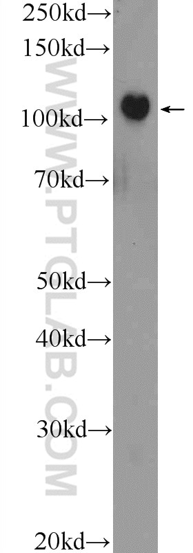 Western Blot (WB) analysis of HEK-293 cells using PRPF6 Polyclonal antibody (23929-1-AP)