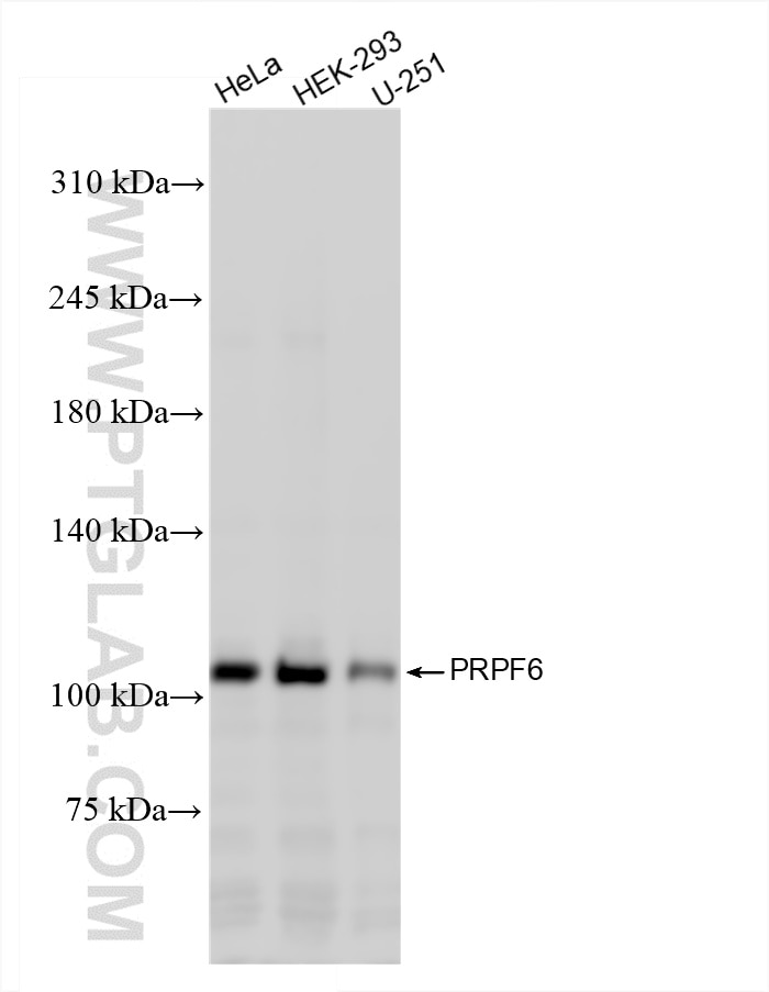 PRPF6