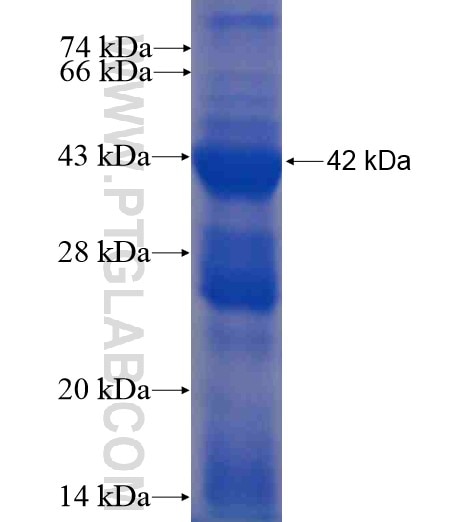PRPF6 fusion protein Ag13817 SDS-PAGE