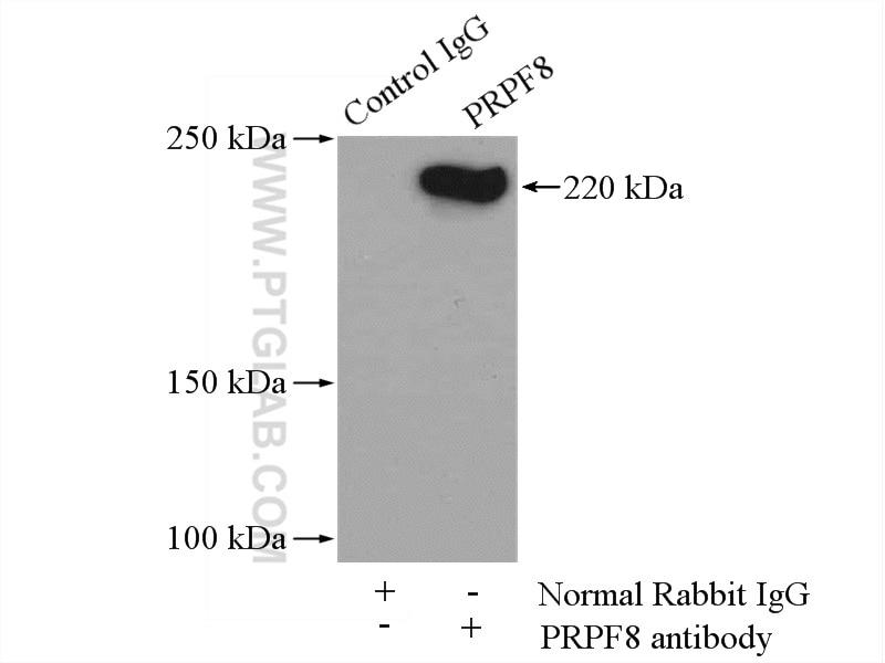 Immunoprecipitation (IP) experiment of HeLa cells using PRPF8 Polyclonal antibody (11171-1-AP)
