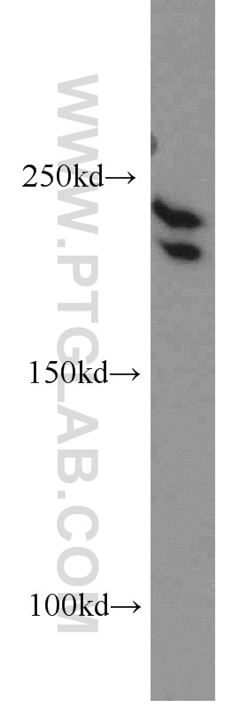 Western Blot (WB) analysis of human placenta tissue using PRPF8 Polyclonal antibody (11171-1-AP)