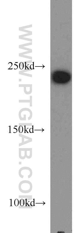 Western Blot (WB) analysis of K-562 cells using PRPF8 Polyclonal antibody (11171-1-AP)