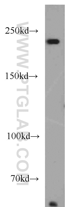 Western Blot (WB) analysis of HeLa cells using PRPF8 Polyclonal antibody (11171-1-AP)