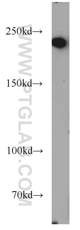 Western Blot (WB) analysis of Jurkat cells using PRPF8 Polyclonal antibody (11171-1-AP)