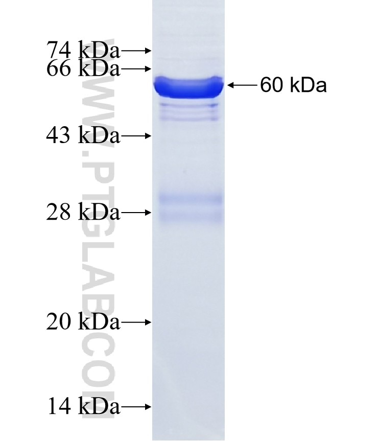 PRPF8 fusion protein Ag1652 SDS-PAGE