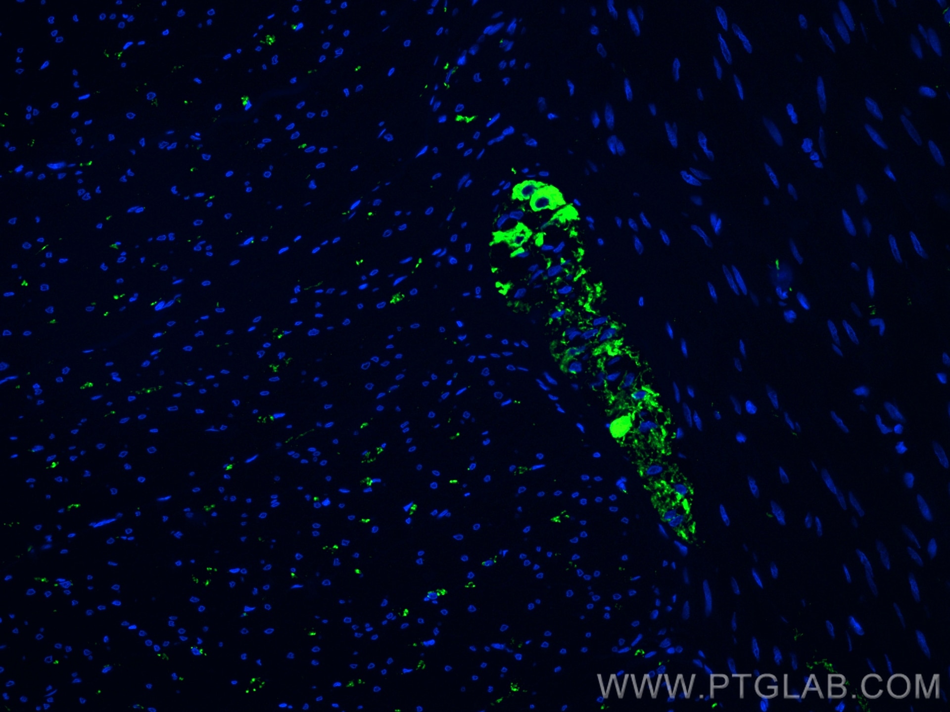 Immunofluorescence (IF) / fluorescent staining of human colon tissue using Peripherin Polyclonal antibody (17399-1-AP)