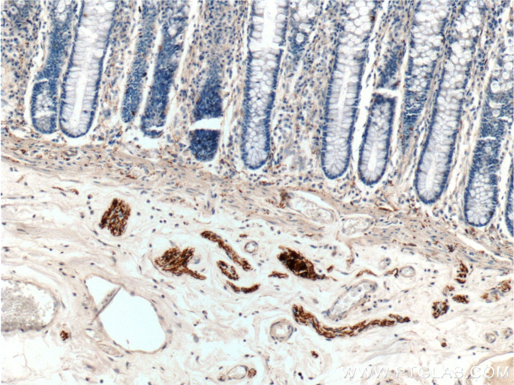 IHC staining of human colon using 17399-1-AP