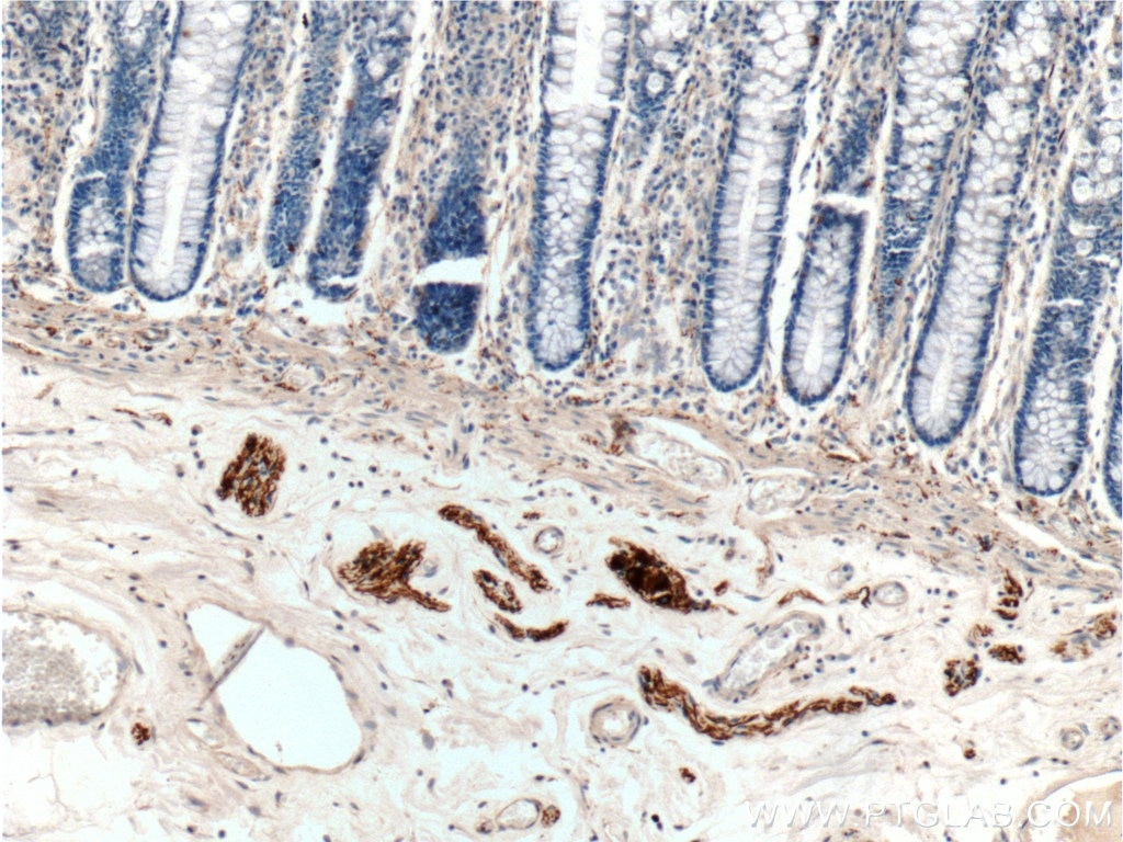 Immunohistochemistry (IHC) staining of human colon tissue using Peripherin Polyclonal antibody (17399-1-AP)