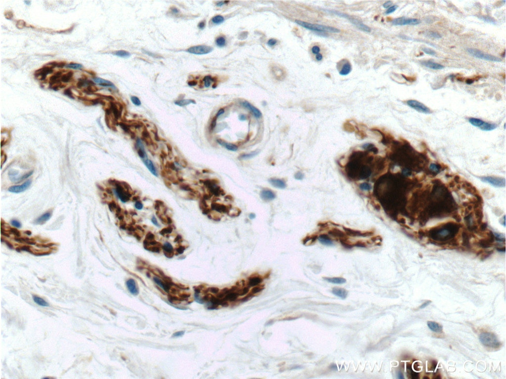 Immunohistochemistry (IHC) staining of human colon tissue using Peripherin Polyclonal antibody (17399-1-AP)