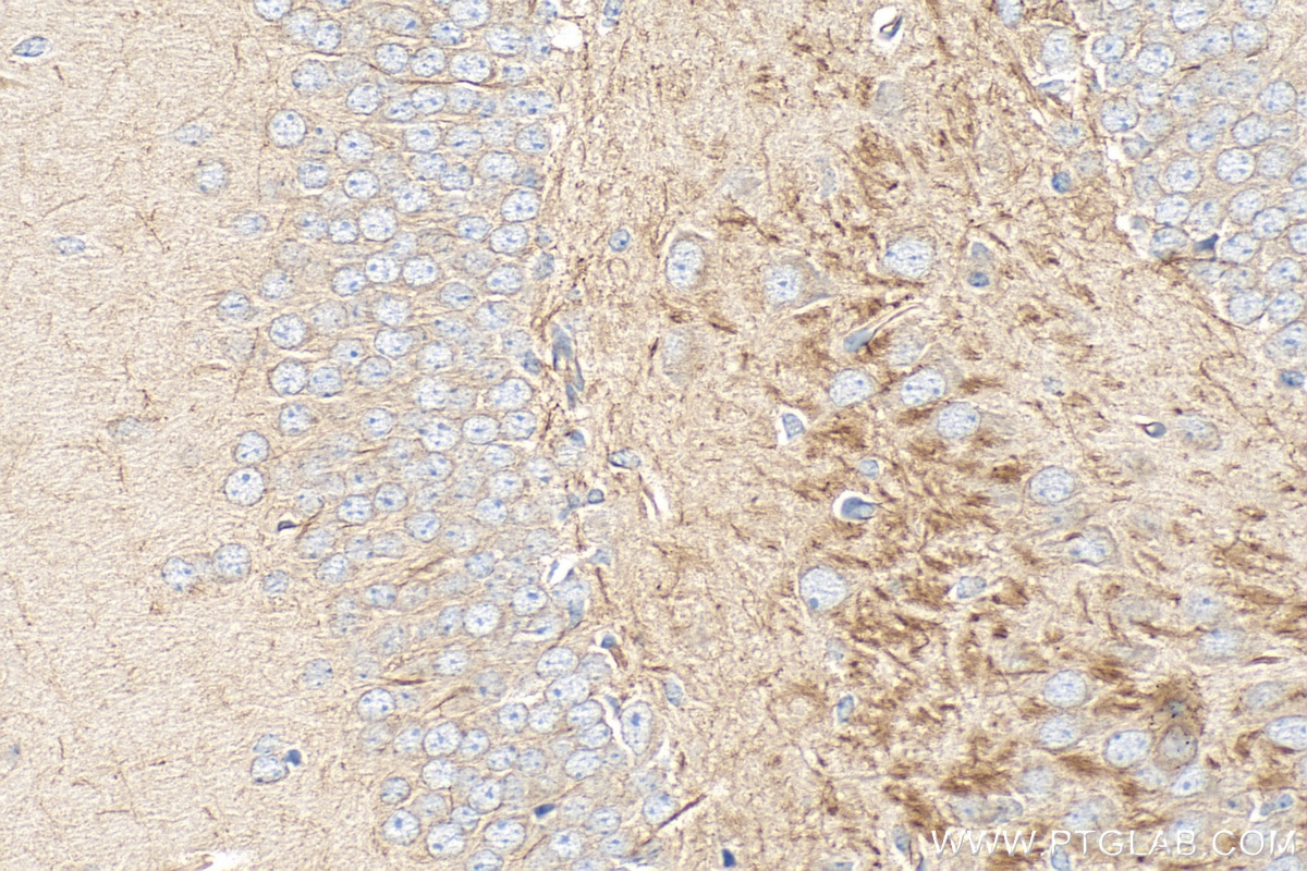 Immunohistochemistry (IHC) staining of mouse brain tissue using Peripherin Polyclonal antibody (17399-1-AP)