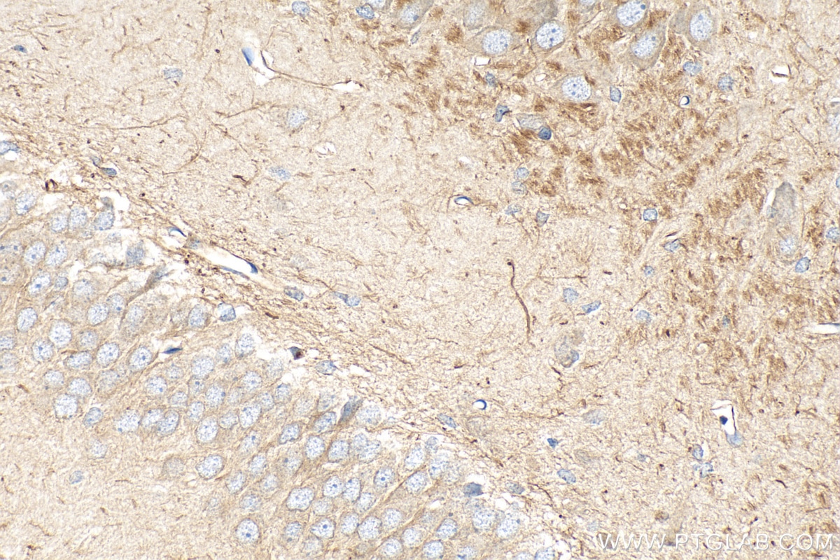 Immunohistochemistry (IHC) staining of rat brain tissue using Peripherin Polyclonal antibody (17399-1-AP)