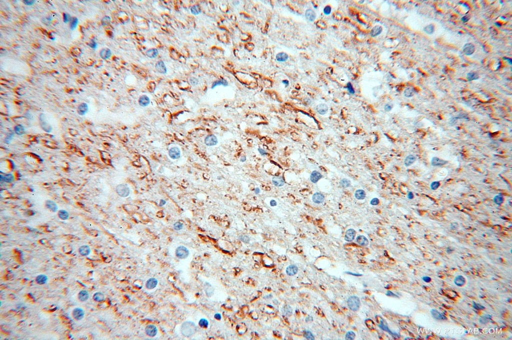 Immunohistochemistry (IHC) staining of human brain tissue using Peripherin Polyclonal antibody (17399-1-AP)