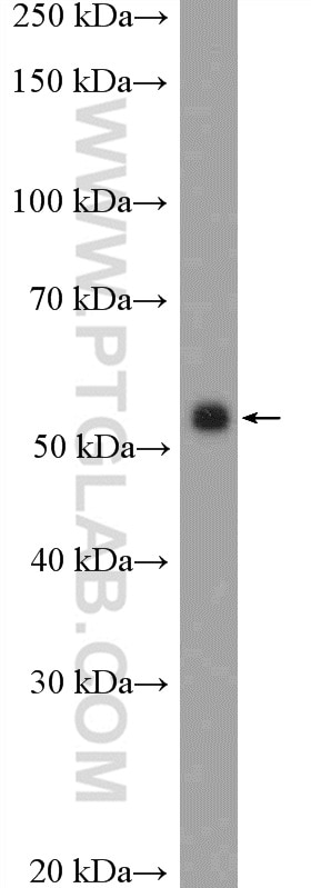 Western Blot (WB) analysis of COLO 320 cells using Peripherin Polyclonal antibody (17399-1-AP)
