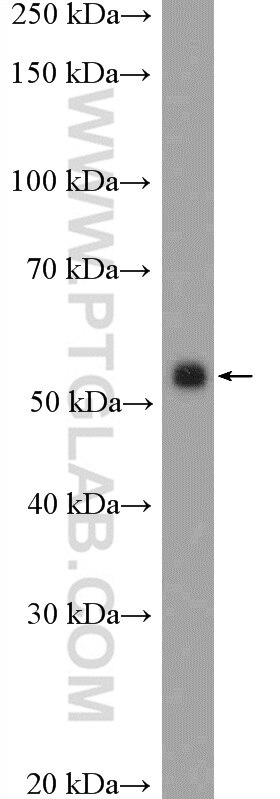 WB analysis of COLO 320 using 17399-1-AP