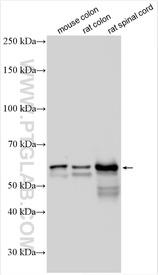 Western Blot (WB) analysis of various lysates using Peripherin Polyclonal antibody (17399-1-AP)