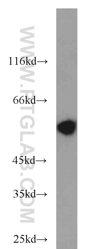 Western Blot (WB) analysis of mouse colon tissue using Peripherin Polyclonal antibody (17399-1-AP)