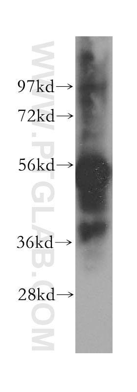 Peripherin