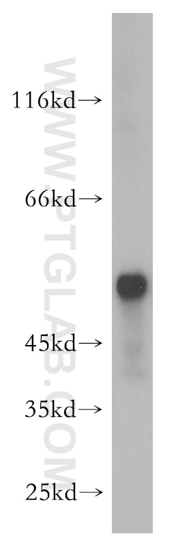 Western Blot (WB) analysis of human colon tissue using Peripherin Polyclonal antibody (17399-1-AP)